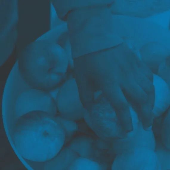 Image of child's hand reaching for a piece of fruit - an example of a healthy and sustainable food